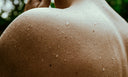Close-up of a person's shoulder with water droplets on a blurred natural background